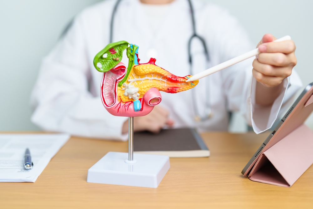 Doctor with human Pancreatitis anatomy model