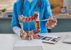 Colon Cancer